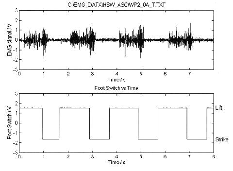 Click to view foot switch emg signal